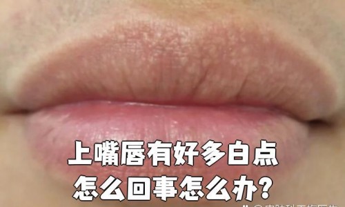 月经期间下雨趟水有事吗-月经期间下雨天能出门吗、月经期间下雨脚泡了凉水 -月经期间下雨网
